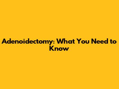 Adenoidectomy: What You Need to Know