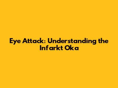 Eye Attack: Understanding the Infarkt Oka